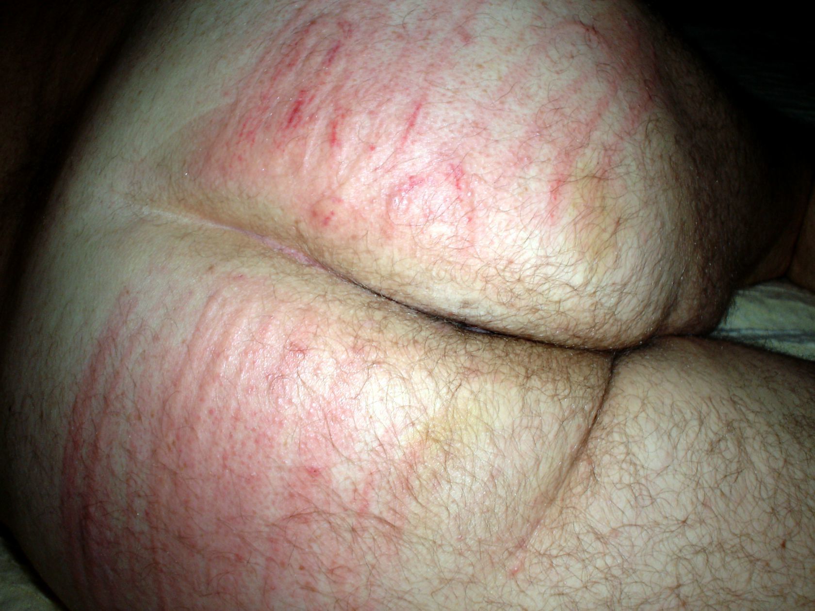 Hard spanking, for cucky, with electric cable. — 26